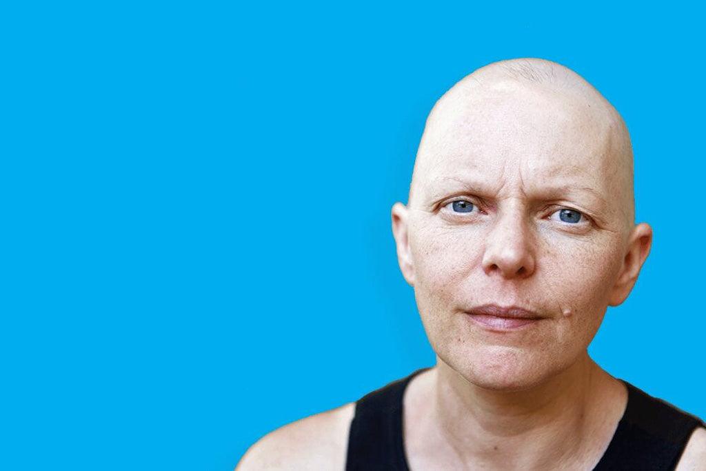 Chemo haircut stories: shaving mom's head - Photo of woman with bald head looking intently at camera.