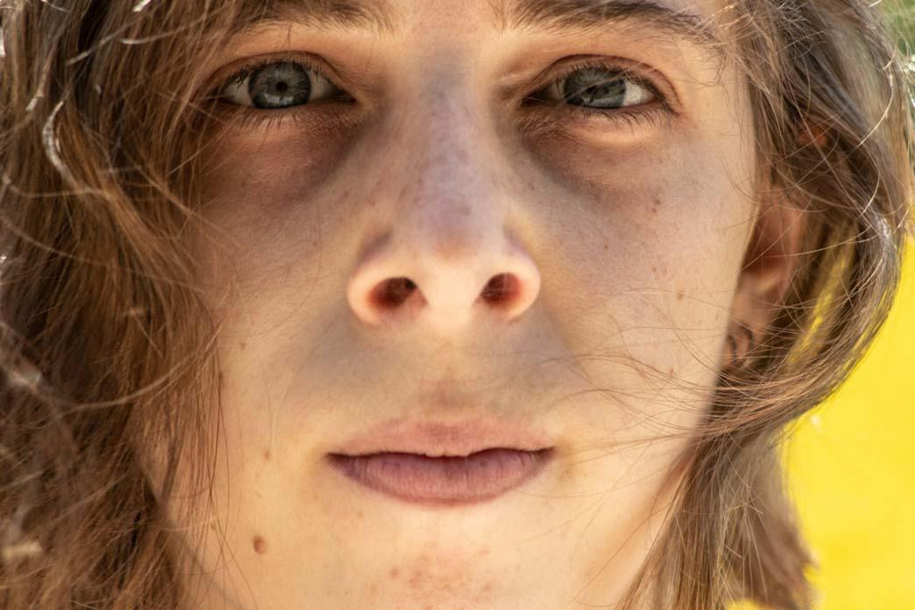 People only see my disability: a close-up portrait of a person's face outdoors.